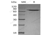 Recombinant Human SENP8 Protein (His Tag)