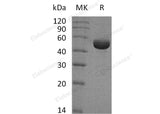 Recombinant Human SHMT1 Protein (His Tag)