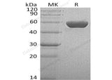 Recombinant Human SerpinA1/A1AT Protein (His Tag)