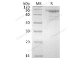 Recombinant Human SerpinA10/SERPINA10 Protein (His Tag)