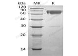 Recombinant Human SerpinA3/AACT Protein (His Tag)