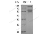 Recombinant Human SerpinA4/SERPINA4 Protein (His Tag)