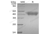 Recombinant Human SerpinA5/SERPINA5 Protein (His Tag)