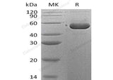 Recombinant Human SerpinB12/SERPINB12 Protein (His Tag)