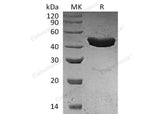 Recombinant Human SerpinB3/SCCA1 Protein (E.coli, His Tag)