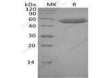 Recombinant Human SerpinF1/PEDF Protein (His Tag)