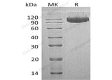 Recombinant Human SerpinG1/C1IN Protein (His Tag)