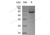 Recombinant Human SerpinH1/SERPINH1 Protein (His Tag)