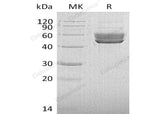 Recombinant Human SerpinI2 Protein (His Tag)