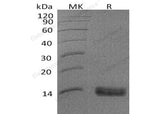 Recombinant Human SPINK1 Protein (His Tag)