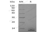 Recombinant Human SSPINK7/ECG2 Protein (His Tag)