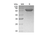 Recombinant Human Serum Albumin/HSA Protein (His Tag)