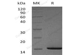 Recombinant Human Serum Amyloid A1/SAA1 Protein (His Tag)