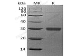 Recombinant Human APCS/SAP Protein (His Tag)