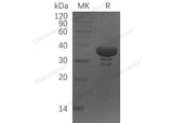 Recombinant Human SGTA Protein (His Tag)