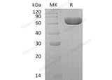 Recombinant Human SIAE Protein (Human Cells, His Tag)