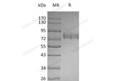 Recombinant Human SIGLEC3/CD33 Protein (Fc & His Tag)