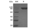 Recombinant Human SIGLEC9/CD329 Protein (Fc Tag)