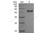 Recombinant Human Sialidase-1/NEU-1 Protein (His Tag)