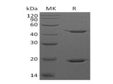 Recombinant Human STAT3 Protein (His Tag)