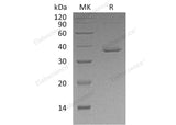 Recombinant Human STAT5B Protein (His Tag)