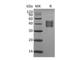 Recombinant Human SLAMF5/CD84 Protein (aa 22-220, His Tag)