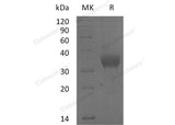 Recombinant Human SLAMF8 Protein (His Tag)