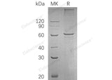 Recombinant Human SMAD4 Protein (His Tag)