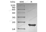 Recombinant Human SUMO2 Protein (His Tag)