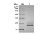 Recombinant Human SUMO3/SMT3A Protein (aa 2-92, His Tag)