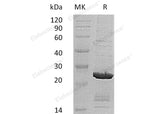 Recombinant Human SOD2/Mn-SOD Protein (His Tag, Human Cells)