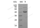 Recombinant Human SORD Protein (His Tag)