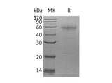 Recombinant Human SPESP1 Protein (His Tag)