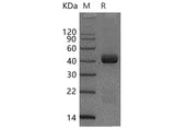 Recombinant Human Spondin 2/SPON2 Protein (His Tag)