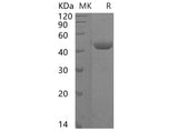 Recombinant Human ST6GALNAC2 Protein (His Tag)