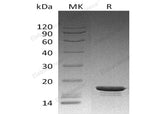 Recombinant Human STMN1 Protein (His Tag)