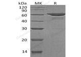 Recombinant Human SOAT2/ACAT2 Protein (His&Trx Tag)