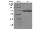 Recombinant Human SUMF1 Protein (His Tag)