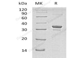 Recombinant Human SULT1A2 Protein (His Tag)