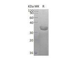 Recombinant Human SULT1C2 Protein (His Tag)