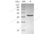 Recombinant Human Sulfotransferase 4A1/SULT4A1 Protein