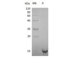 Recombinant Human Sulfotransferase/SULT1C4 Protein (His Tag)