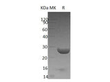 Recombinant Human YKT6 Protein (His Tag)