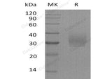 Recombinant Human Syndecan-2/SDC2 Protein (His Tag)(Active)