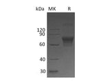 Recombinant Human TIM-3/HAVCR2 Protein (Fc & His Tag)(Active)
