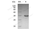 Recombinant Human TRIM/TRAT1 Protein (His Tag)