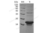 Recombinant Human Tachykinin-3/TAC3 Protein (His Tag)