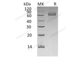 Recombinant Human TGOLN2/TGN38 Homolog Protein (His Tag)