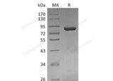 Recombinant Human THOP1 Protein (His Tag)