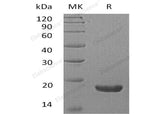 Recombinant Human TXNDC12/ERp18 Protein (His Tag)